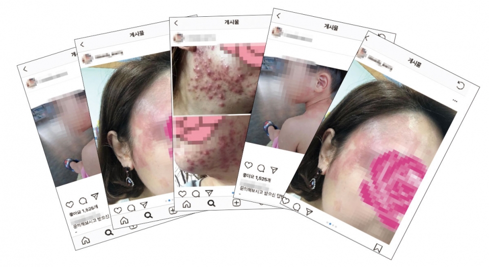 온라인 쇼핑몰 ‘임블리’에 대한 폭로 계정에 올라온 피해사례